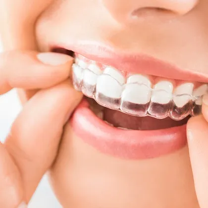Alineadores transparentes de ortodoncia invisible Invisalign