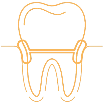 Ilustración de encías sanas y encías con enfermedad periodontal