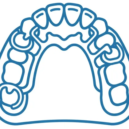 Prótesis dental sobre modelo de arcada
